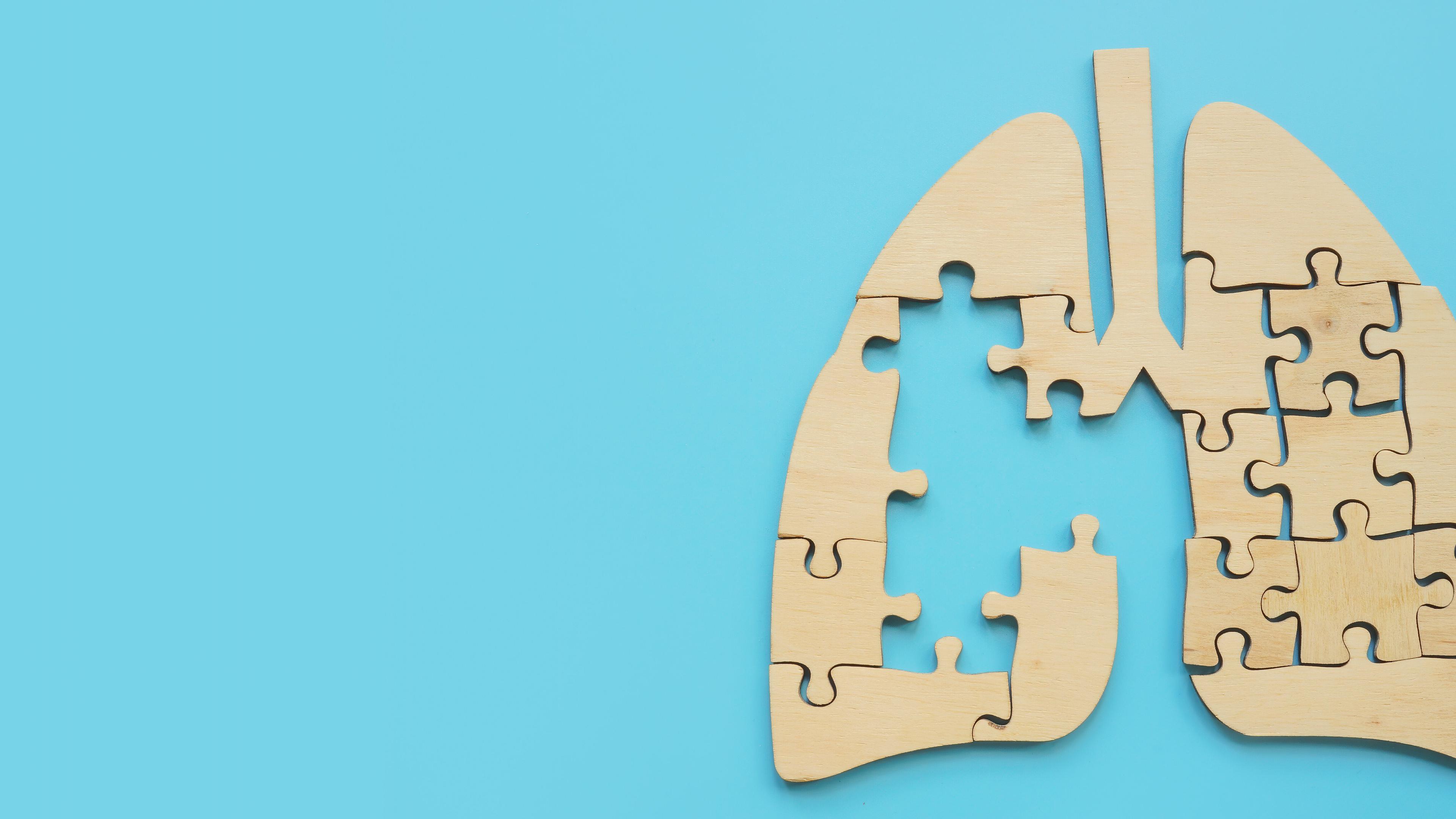 Darstellung der Lunge als Puzzle mit fehlenden Puzzleteilen. © Vitalii Vodolazskyi - stock.adobe.com