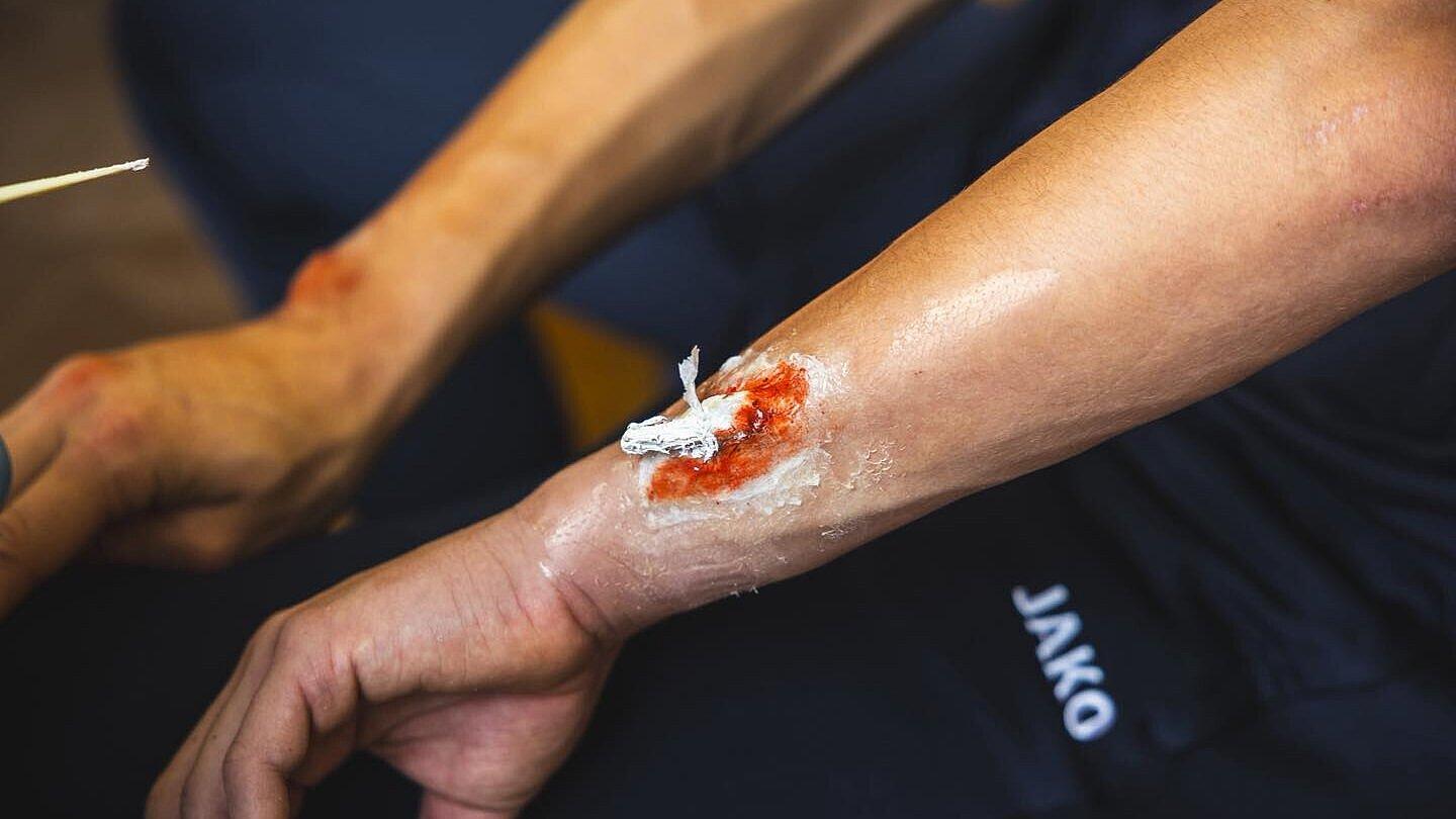 undefined. © Amt für Brand- und Katastrophenschutz. © Amt für Brand- und Katastrophenschutz